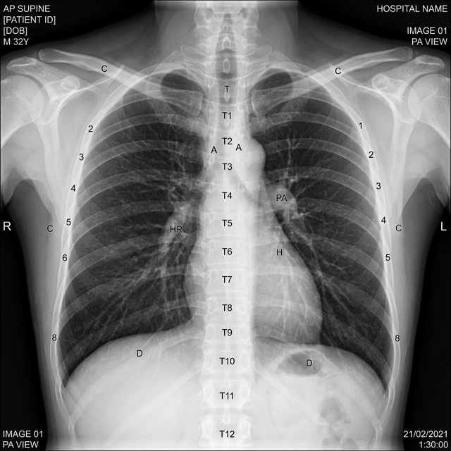 Sample normal radiograph